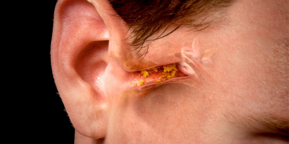 Understanding the Causes of Tinnitus | Ventura ENT Clinic