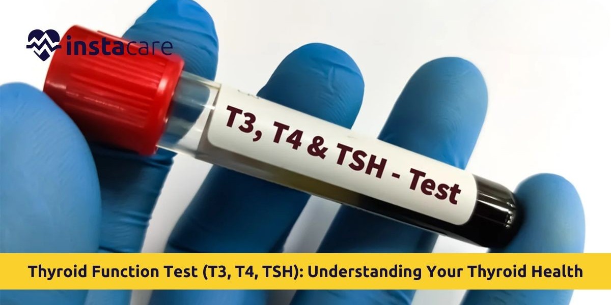 Thyroid Function Test (TFT): Everything You Need to Know