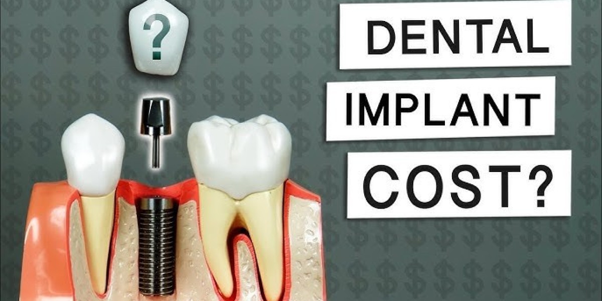 Budgeting for a Brighter Smile: Understanding the Cost of Dental Implants in Panacea, FL