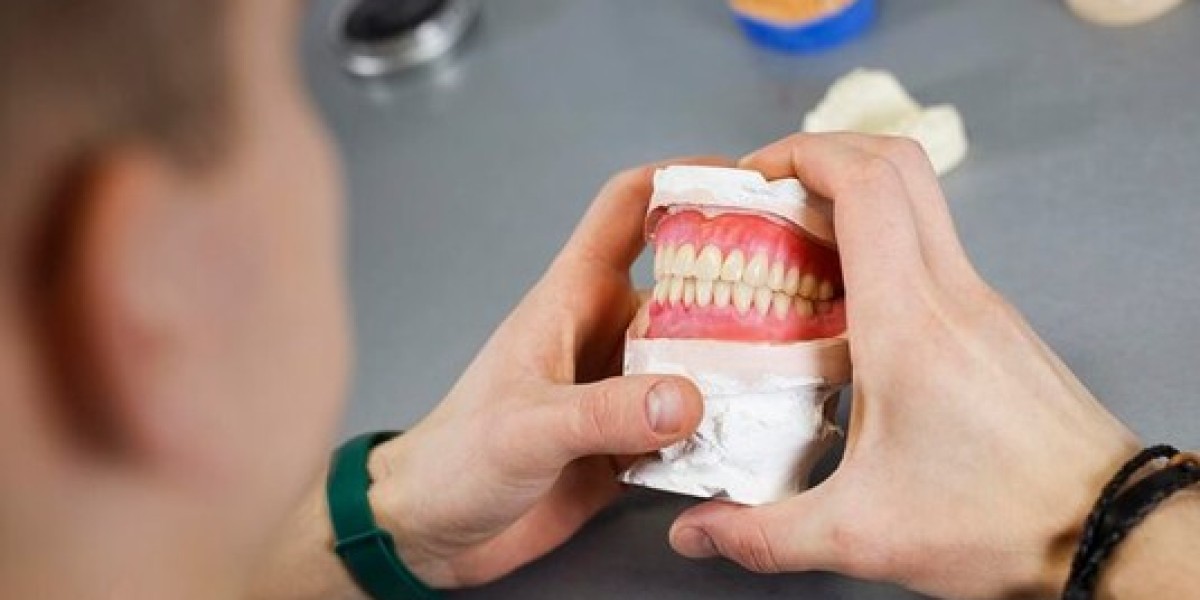 Permanent Feeling Dentures Supported by Dental Implants