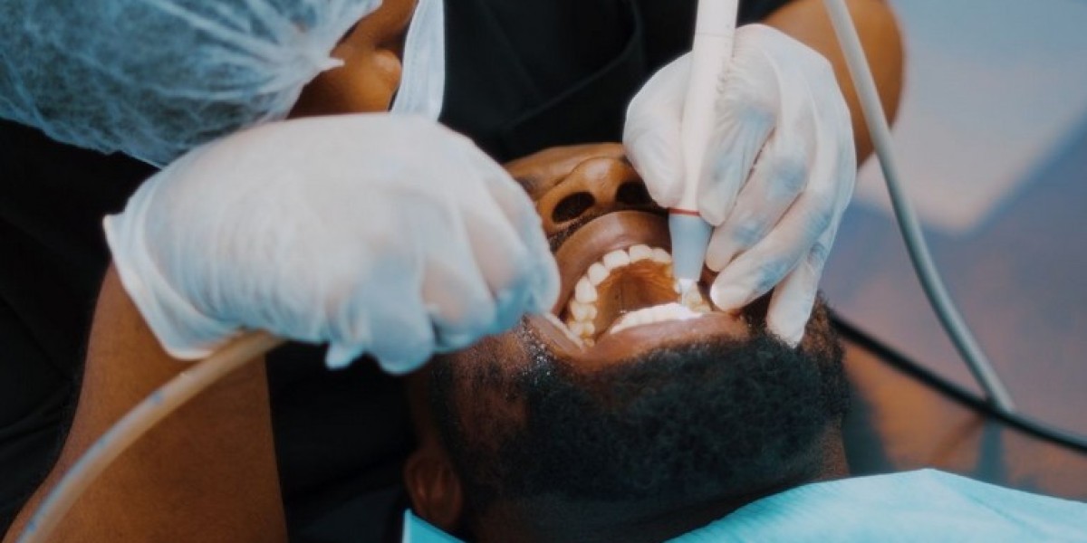 Preventive Dental Care: Benefits of Using Ultrasonic Scalers for Teeth Cleaning