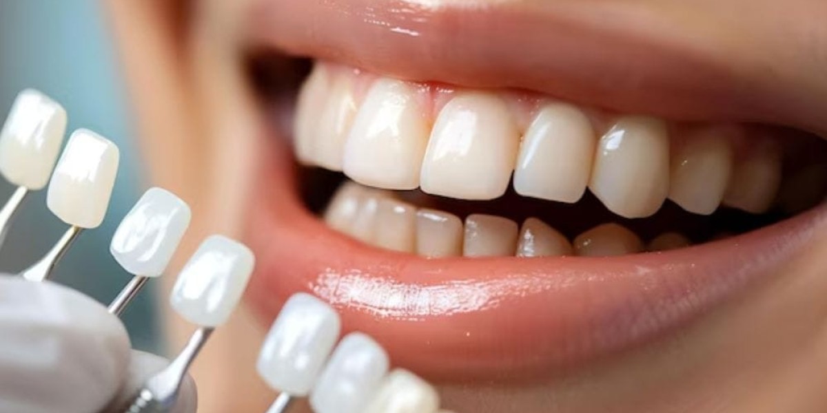 Smart Ways to Choose a Dentist Newport Beach CA That Fits Your Dental Goals
